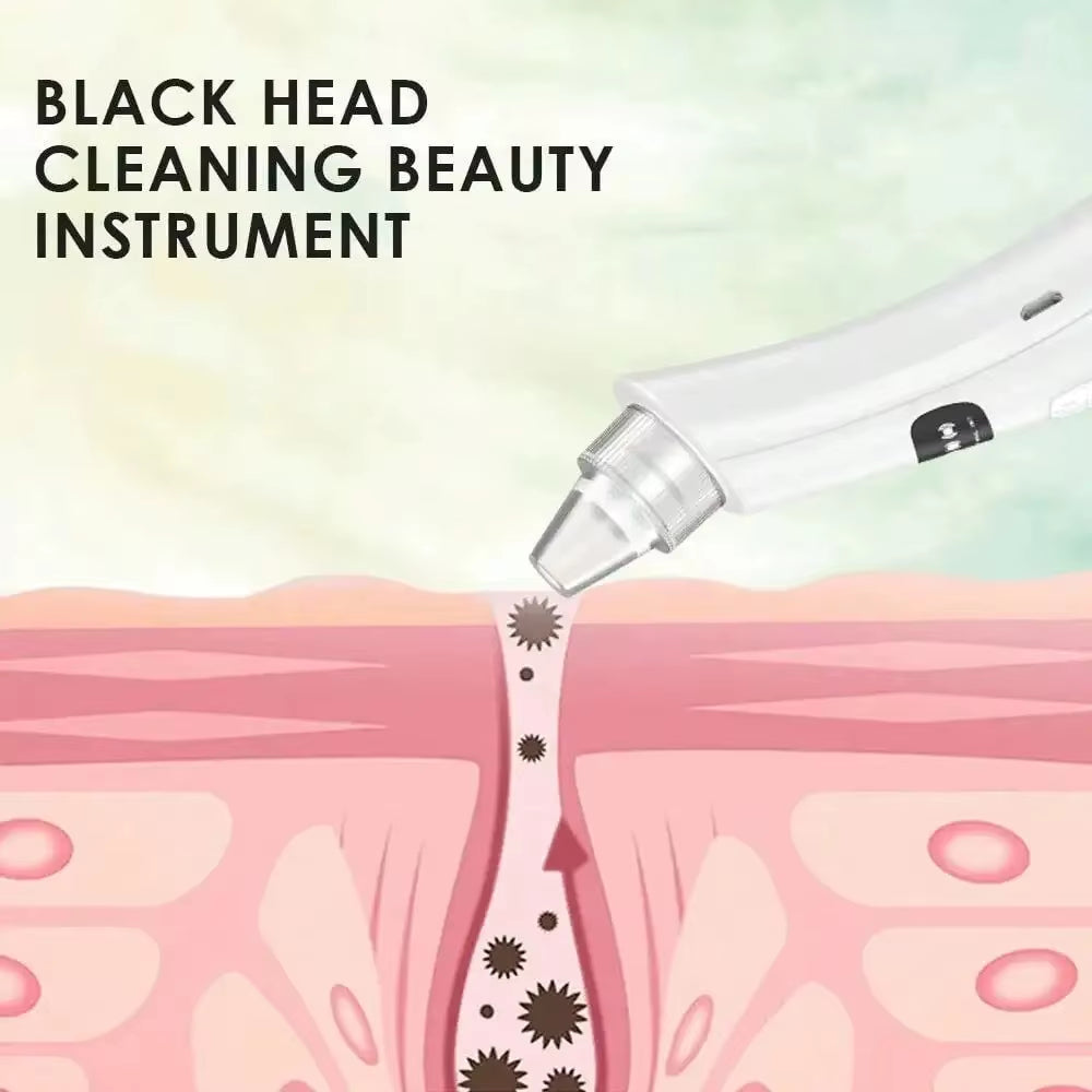 3-Suction Mode Facial Cleansing Device - Vacuum Pore Cleaner for Blackhead & Dead Skin Removal
